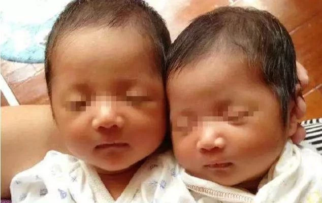  產婦艱難誕下「雙胞胎」，就在全家人歡呼高興時，醫生卻說：這可不是「雙胞胎 」